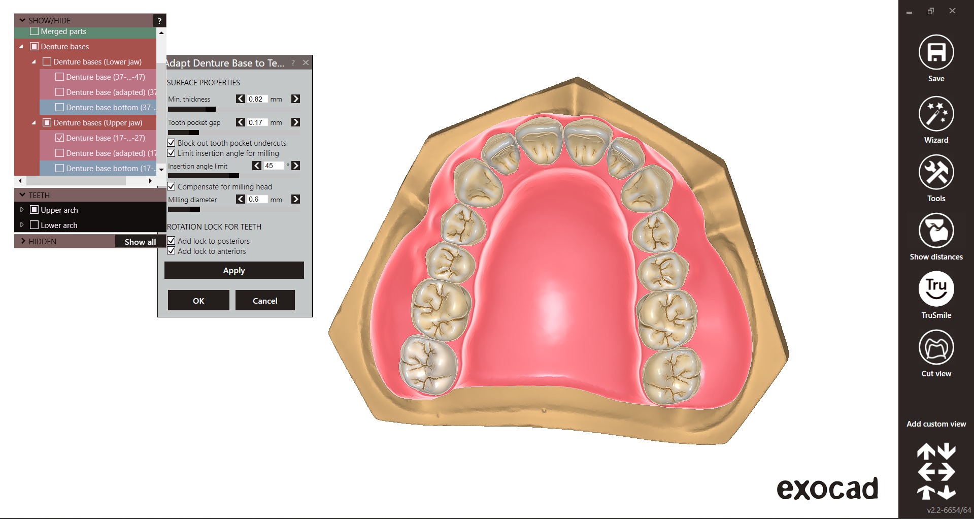 Digital exocad Complete Dentures  3D print model_33