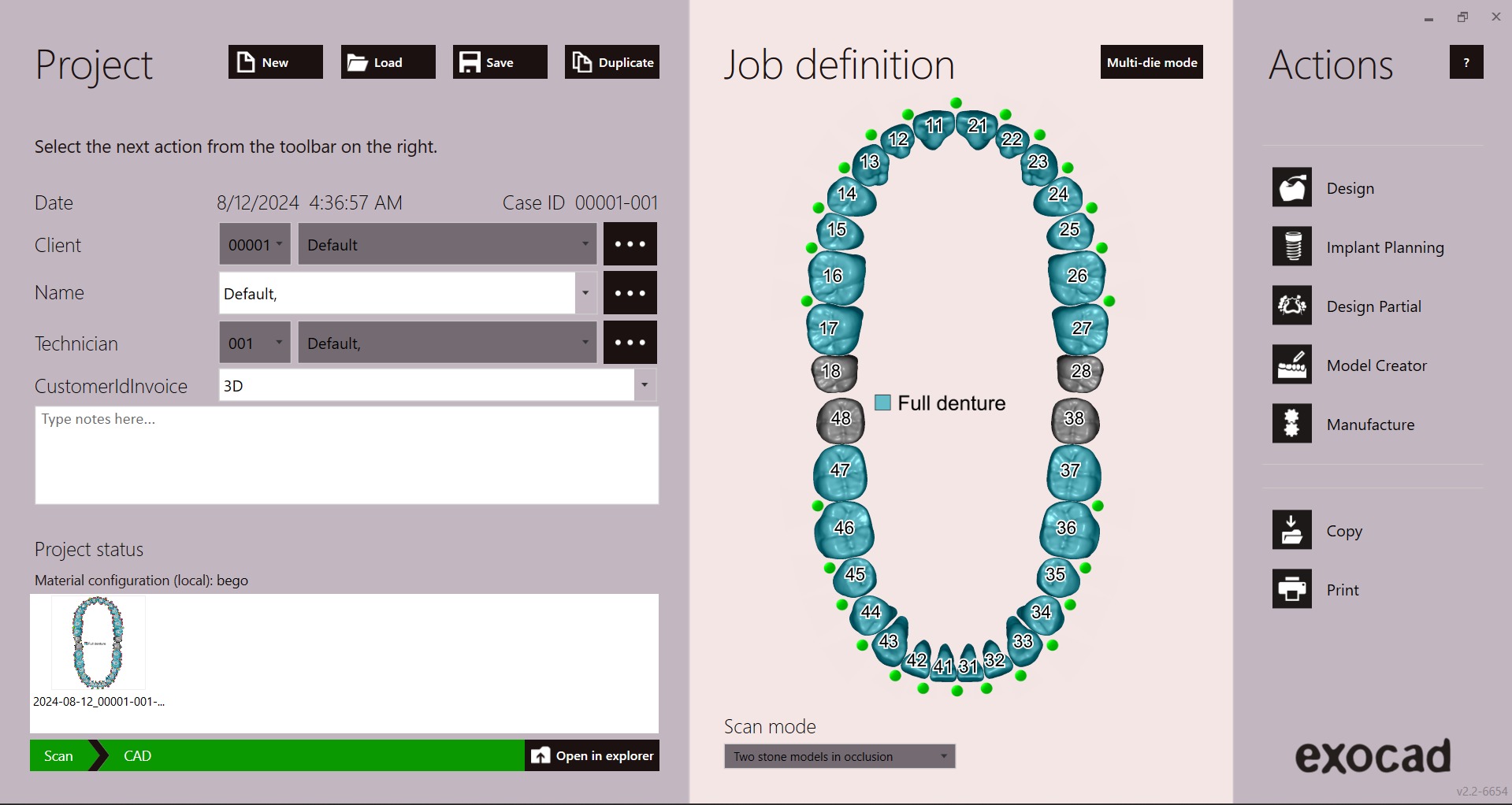 Digital exocad Complete Dentures  3D print model_31