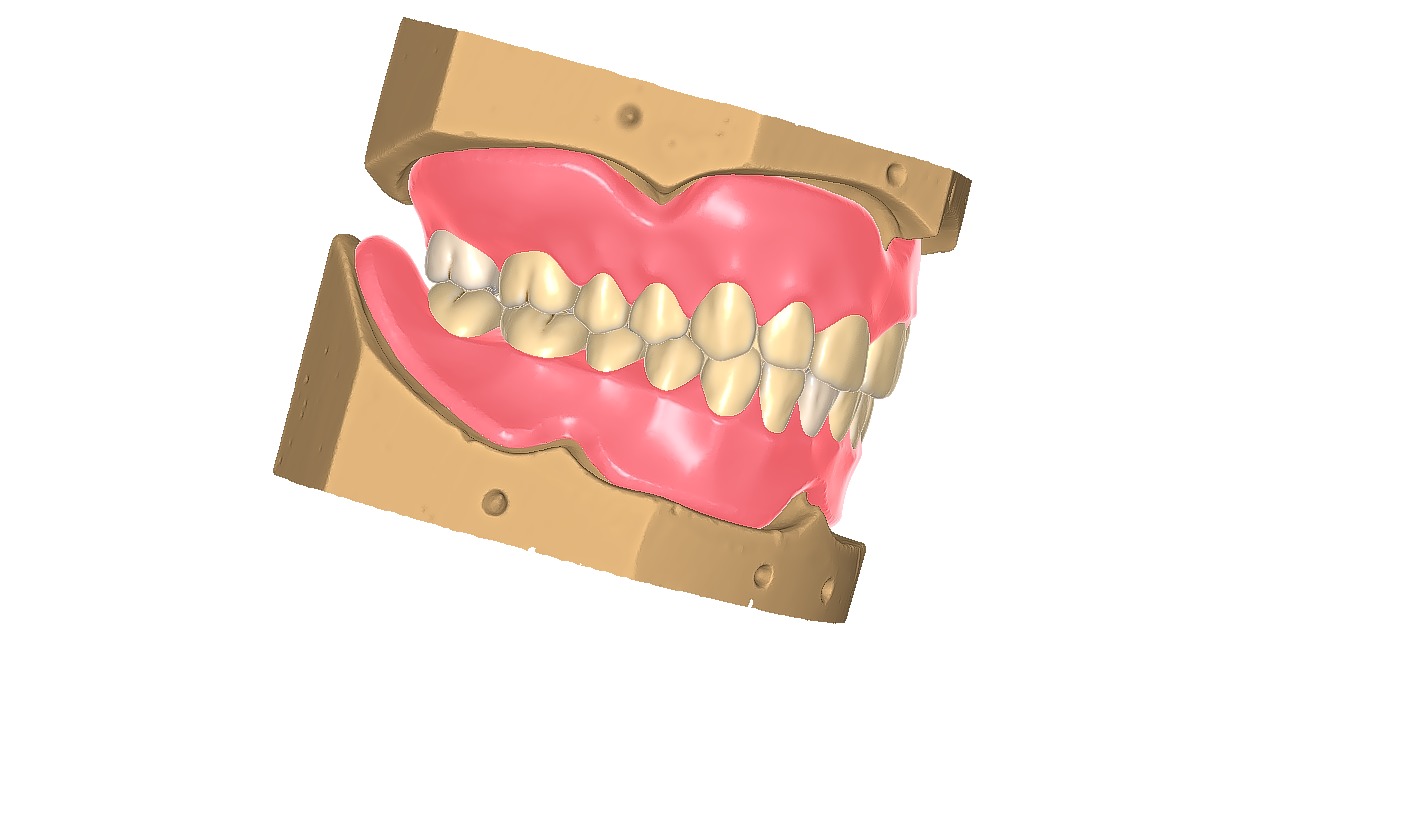 Digital exocad Complete Dentures  3D print model_42