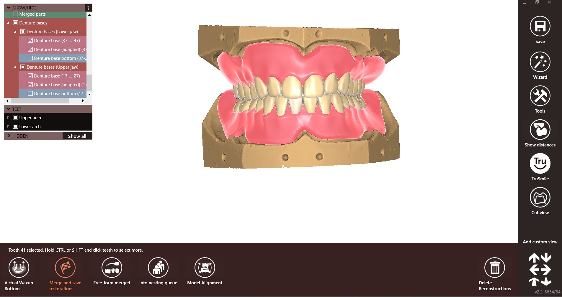 Digital exocad Complete Dentures  3D print model_25