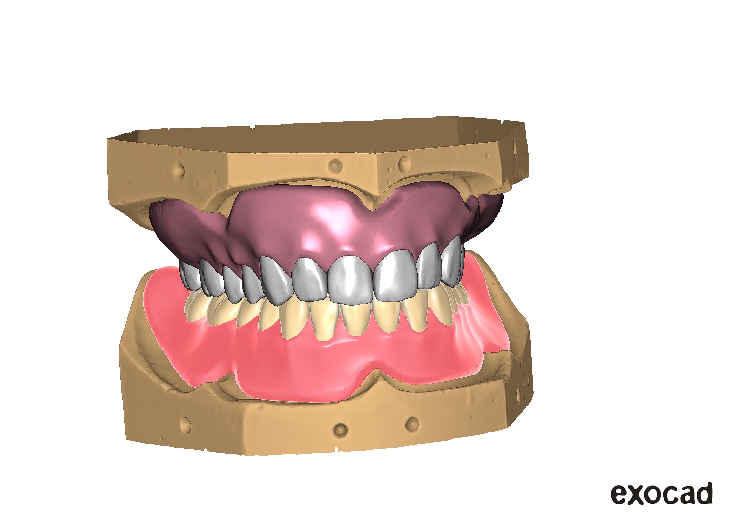 Digital exocad Complete Dentures  3D print model_45