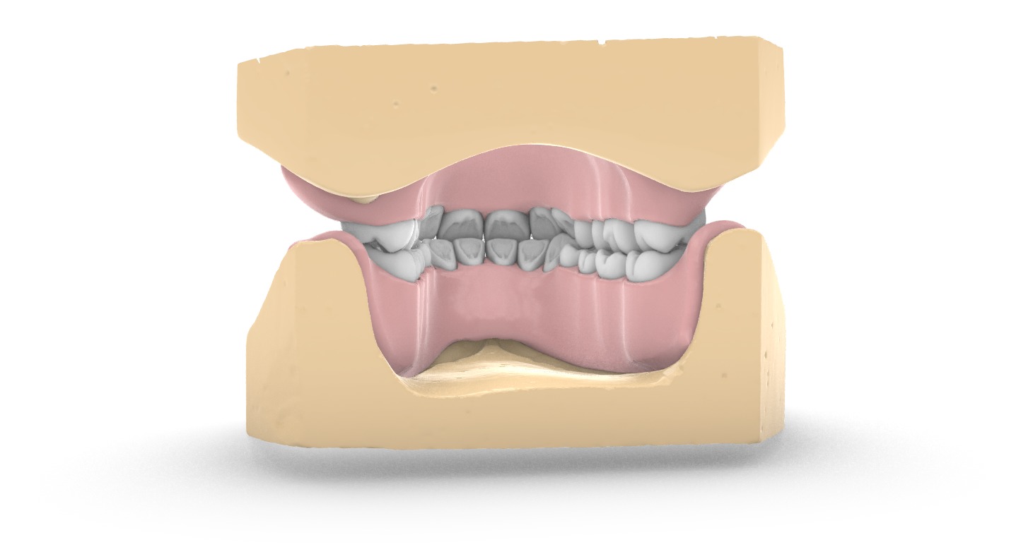 Digital exocad Complete Dentures  3D print model_11