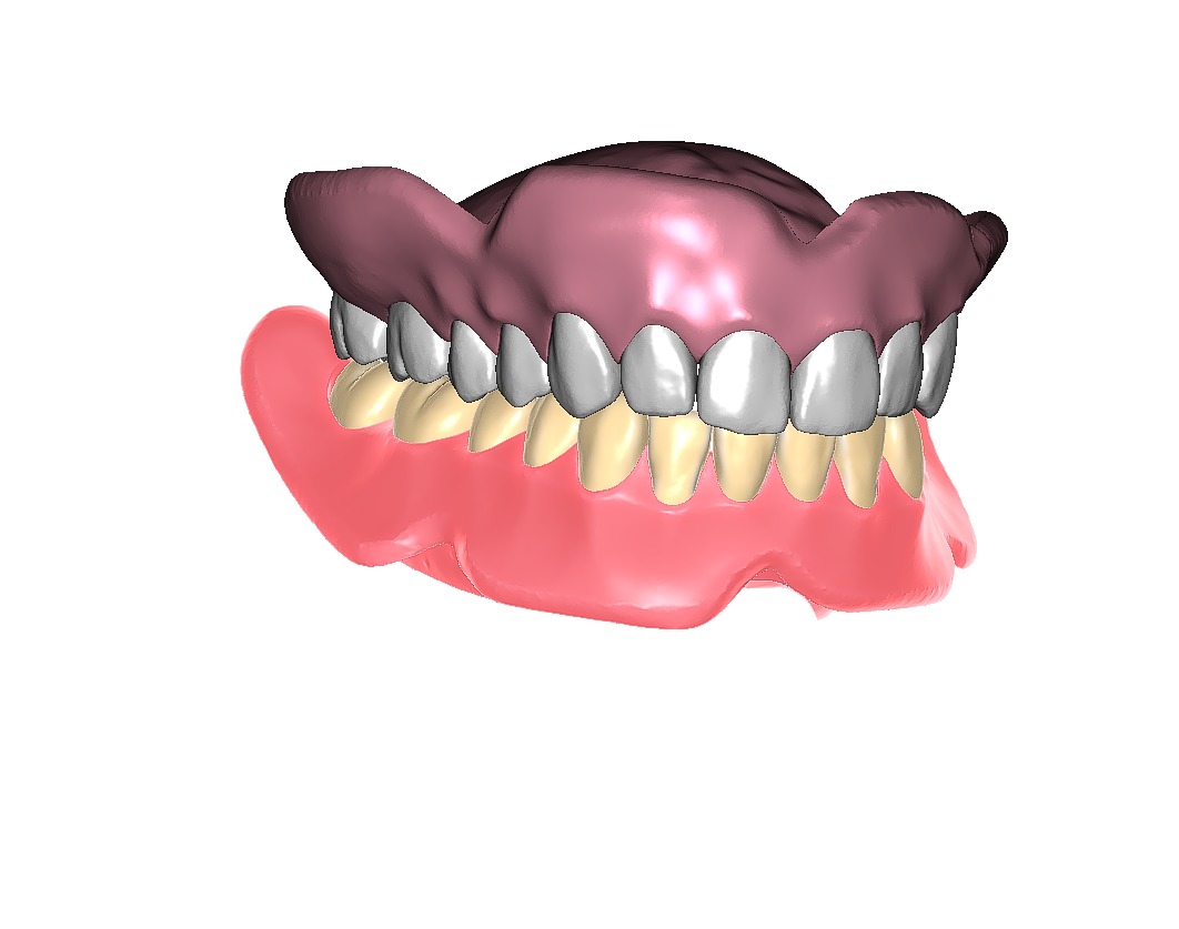 Digital exocad Complete Dentures  3D print model_28