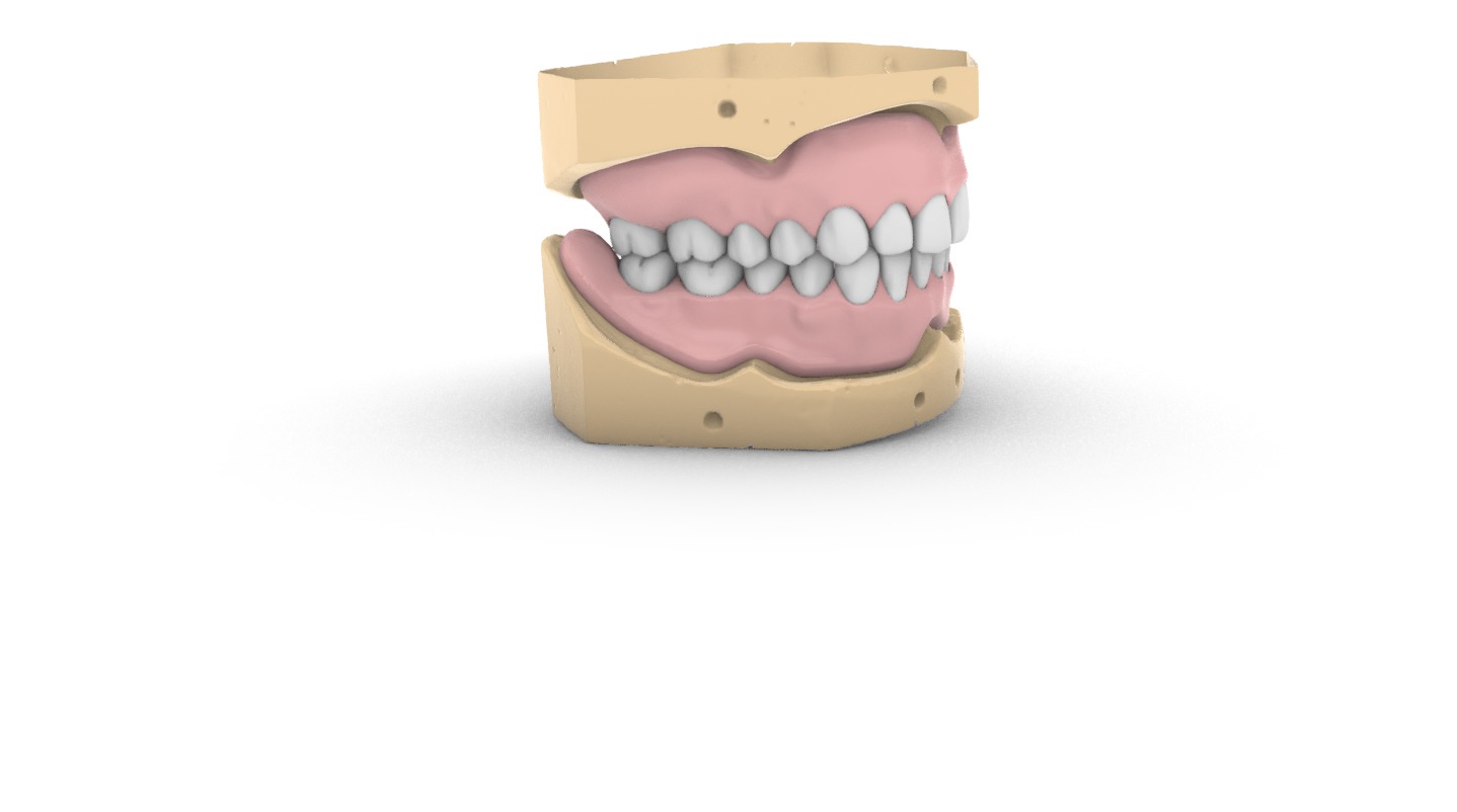 Digital exocad Complete Dentures  3D print model_5