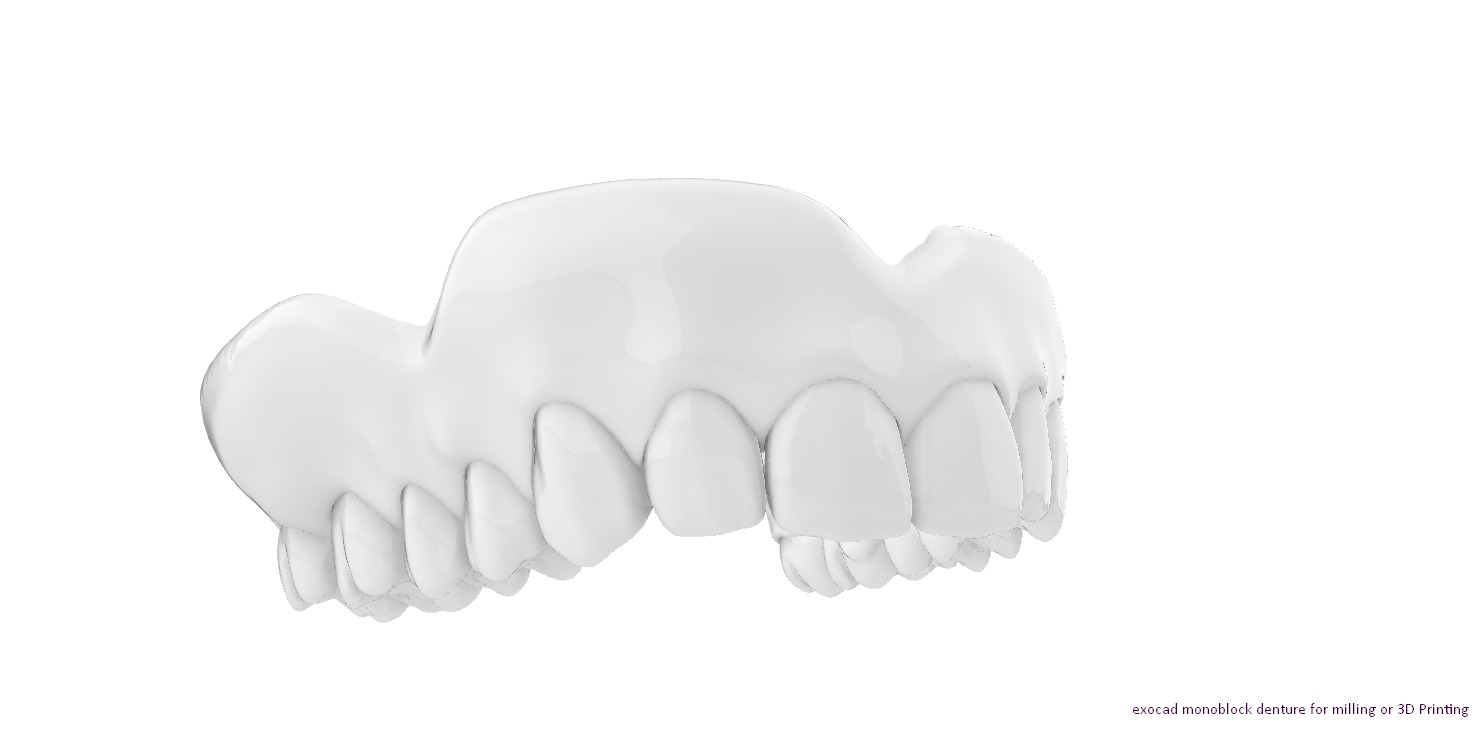Digital exocad Complete Dentures  3D print model_51