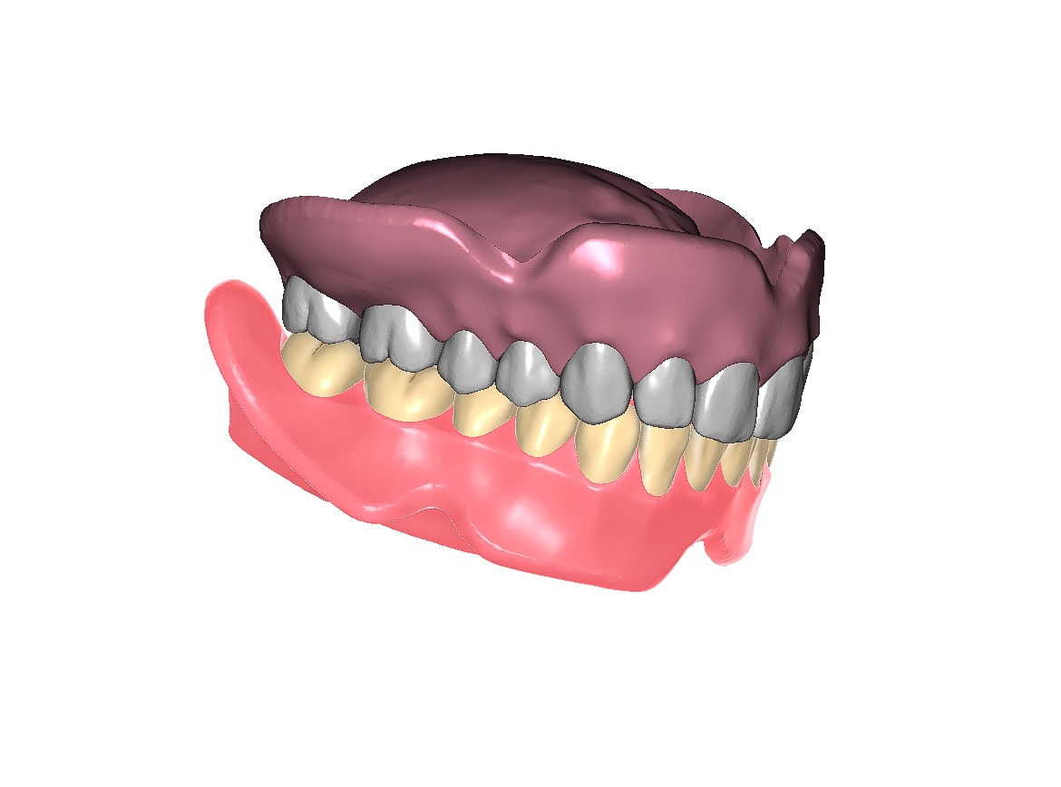 Digital exocad Complete Dentures  3D print model_40