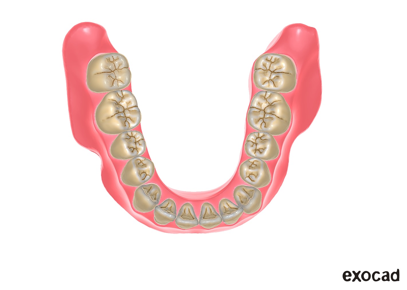 Digital exocad Complete Dentures  3D print model_50