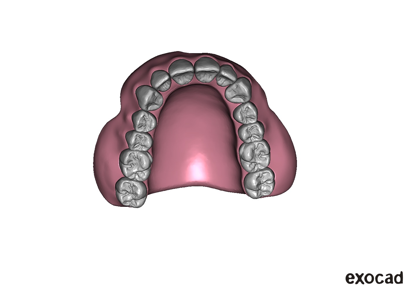 Digital exocad Complete Dentures  3D print model_39