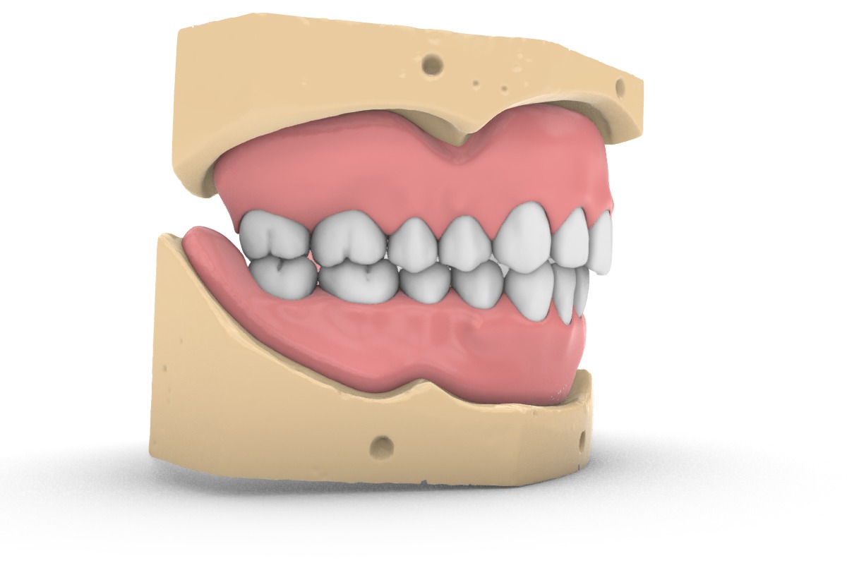 Digital exocad Complete Dentures  3D print model_16