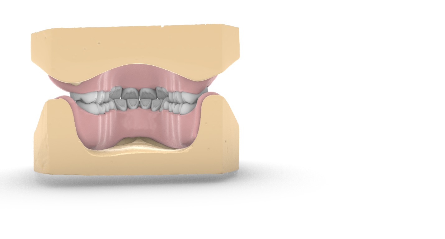 Digital exocad Complete Dentures  3D print model_14