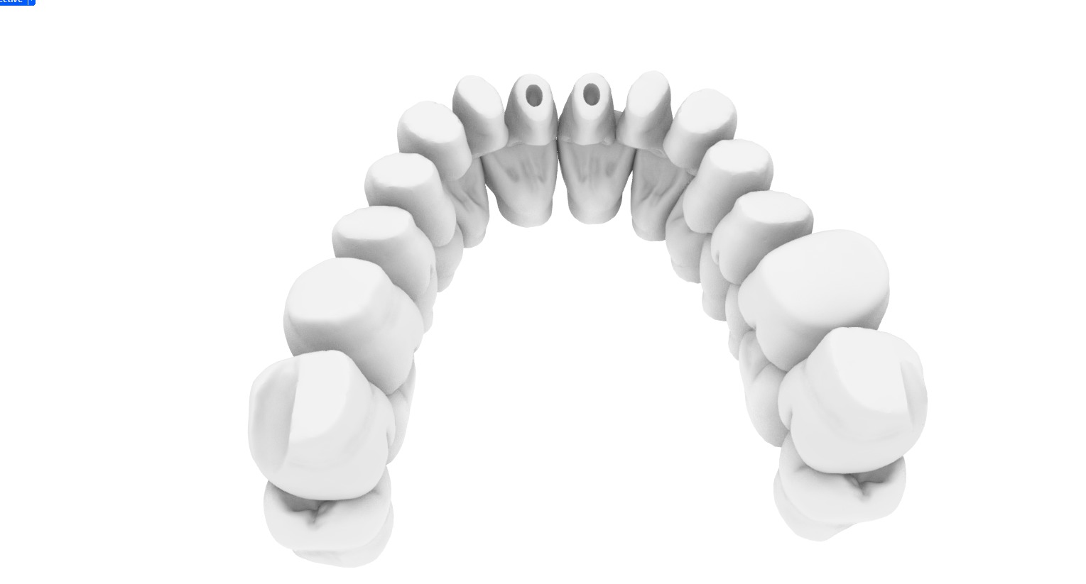 Digital exocad Complete Dentures  3D print model_4