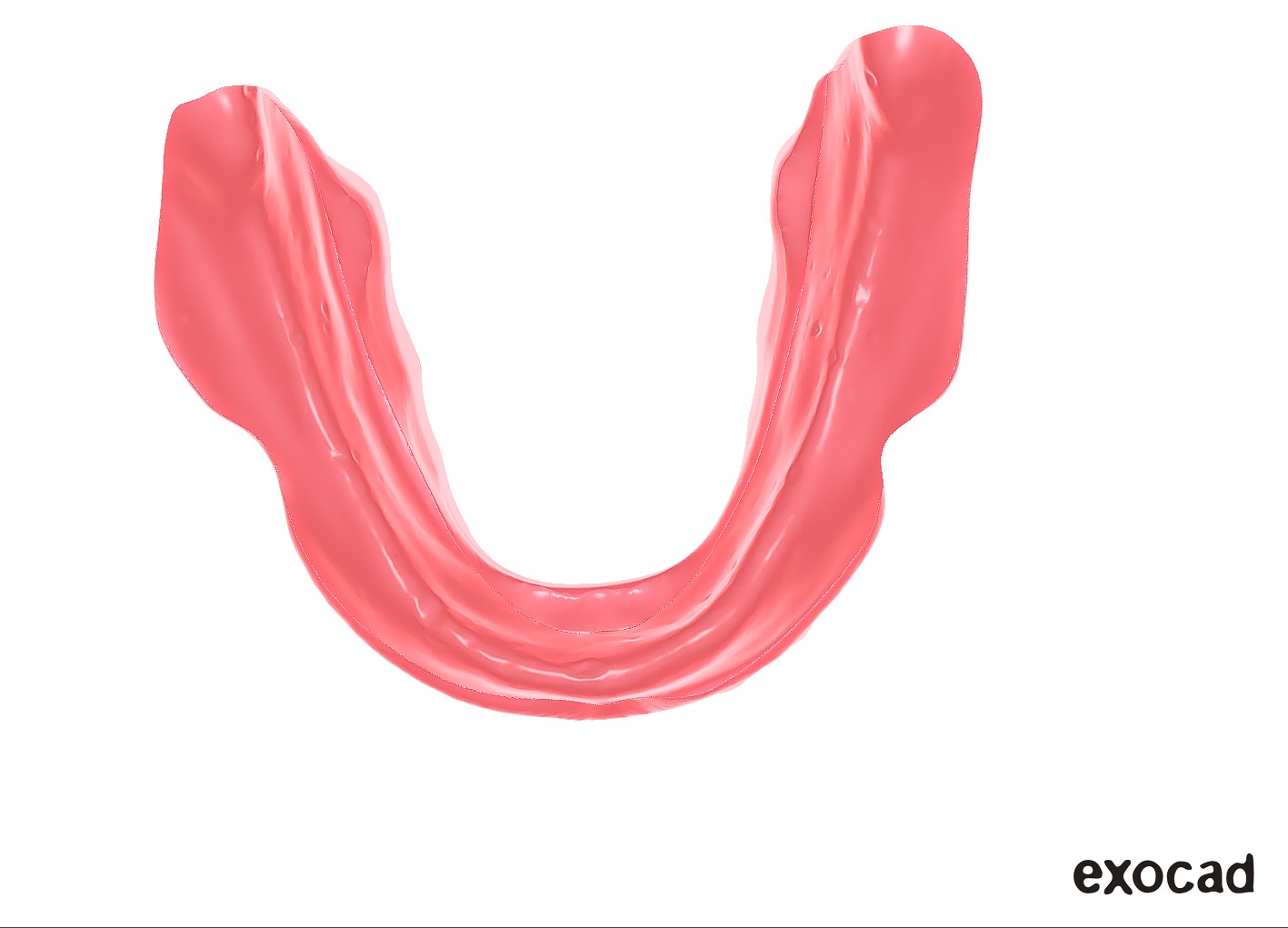 Digital exocad Complete Dentures  3D print model_34