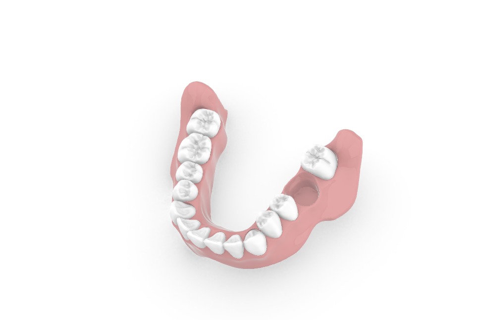 Digital exocad Complete Dentures  3D print model_53