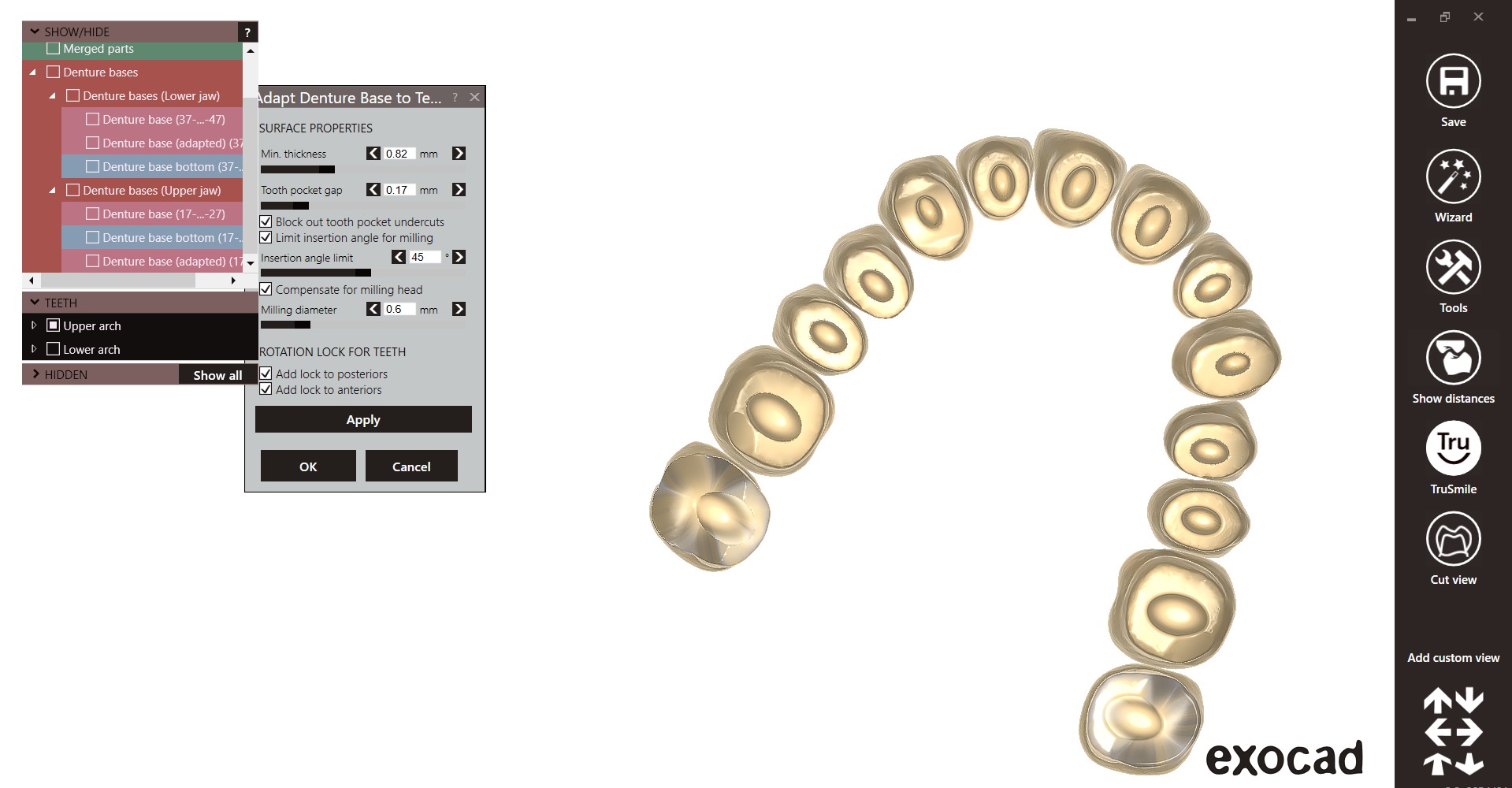 Digital exocad Complete Dentures  3D print model_48