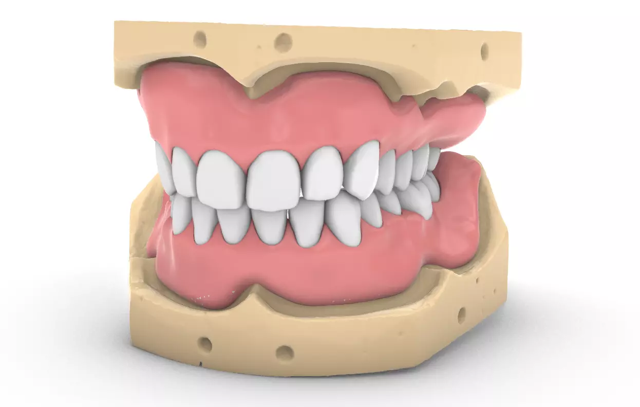 Digital exocad Complete Dentures  3D print model_0