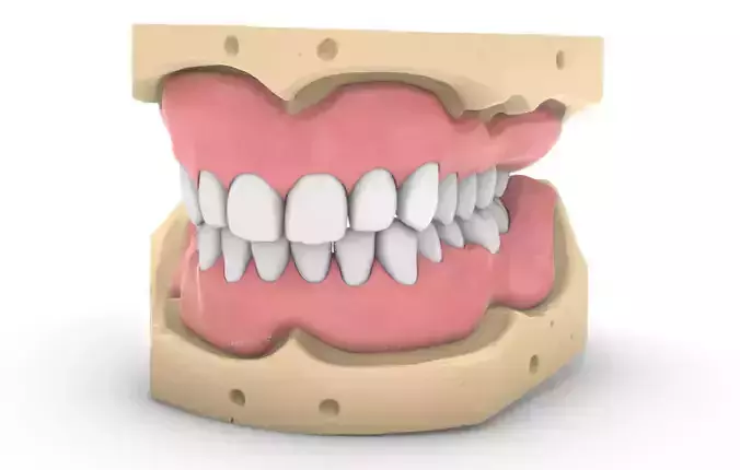 Digital exocad Complete Dentures 