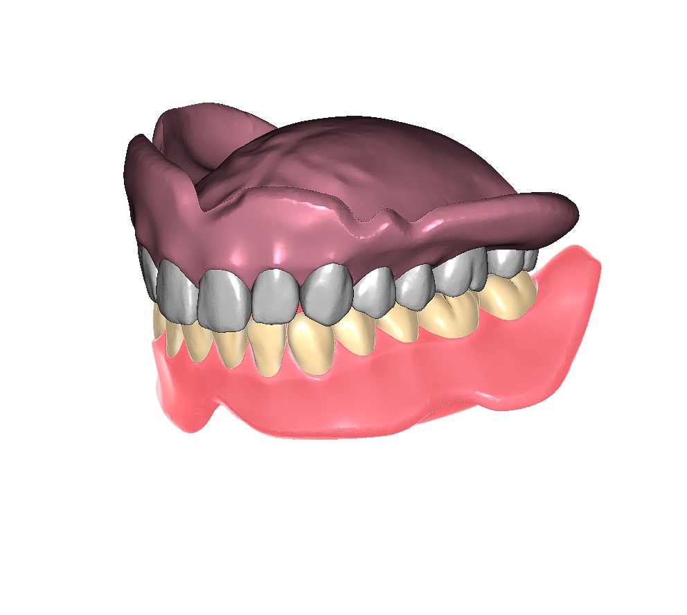 Digital exocad Complete Dentures  3D print model_29