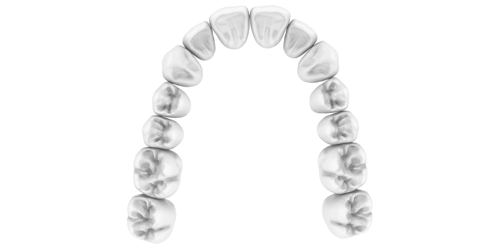 Digital exocad Complete Dentures  3D print model_6