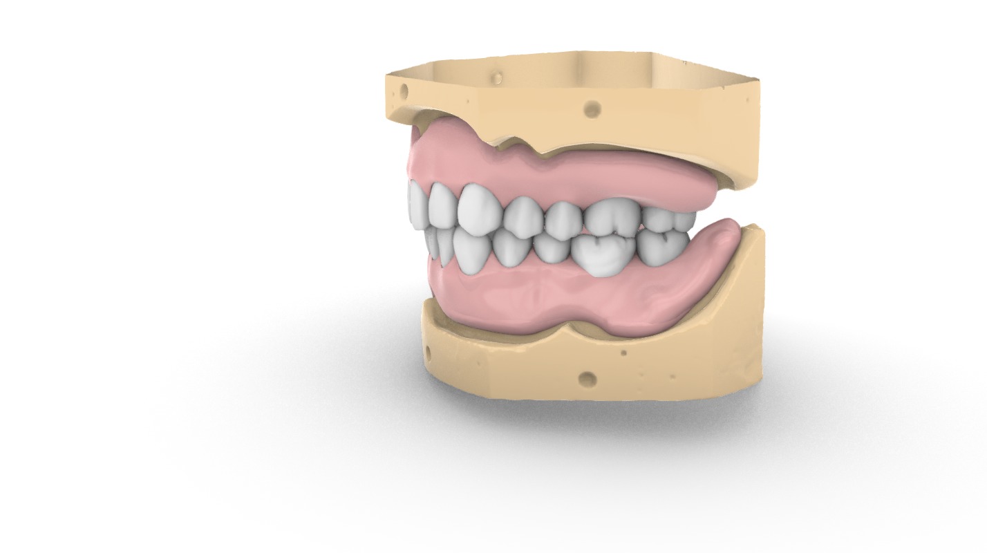 Digital exocad Complete Dentures  3D print model_15