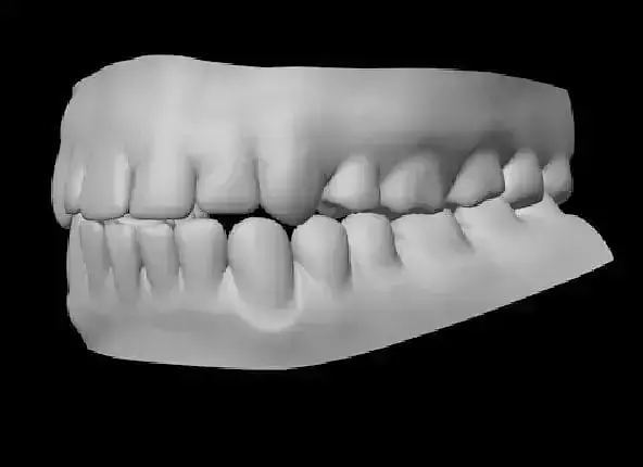 Teeth