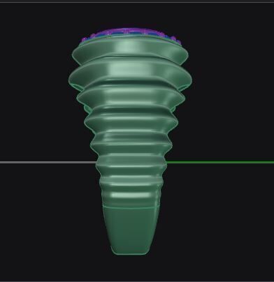 Wavy ring for men consists of bezel set center stone 3D print model_25