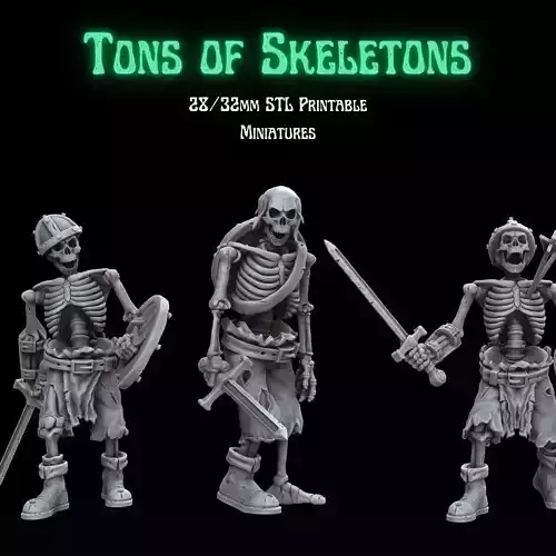 TONS OF SKELETONS - EQUIPPED SKELETONS