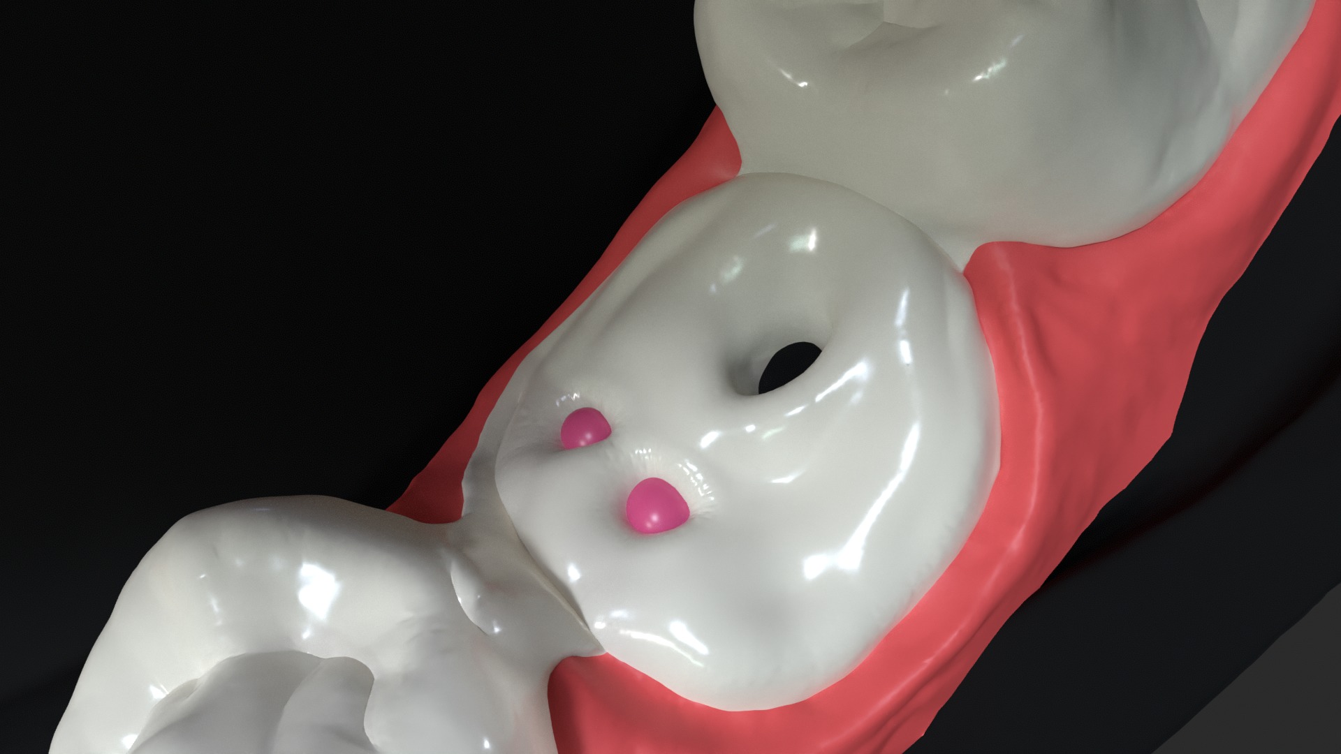 Human Dental Anatomy Mouth with Detached Crown and Inlay  3D print model_10