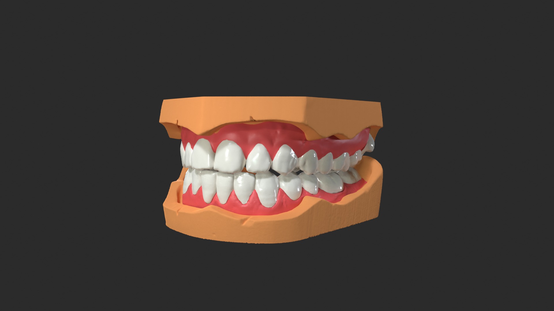 Human Dental Anatomy Mouth with Detached Crown and Inlay  3D print model_7