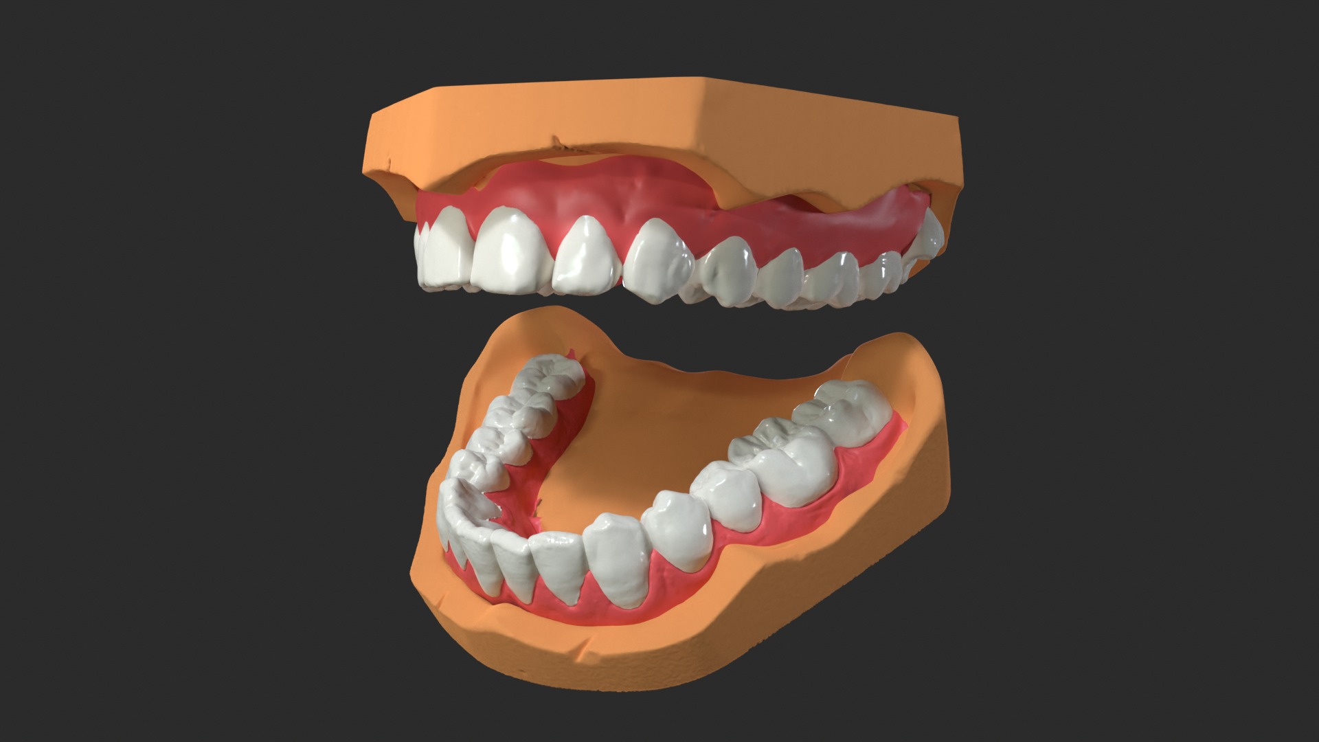 Human Dental Anatomy Mouth with Detached Crown and Inlay  3D print model_5