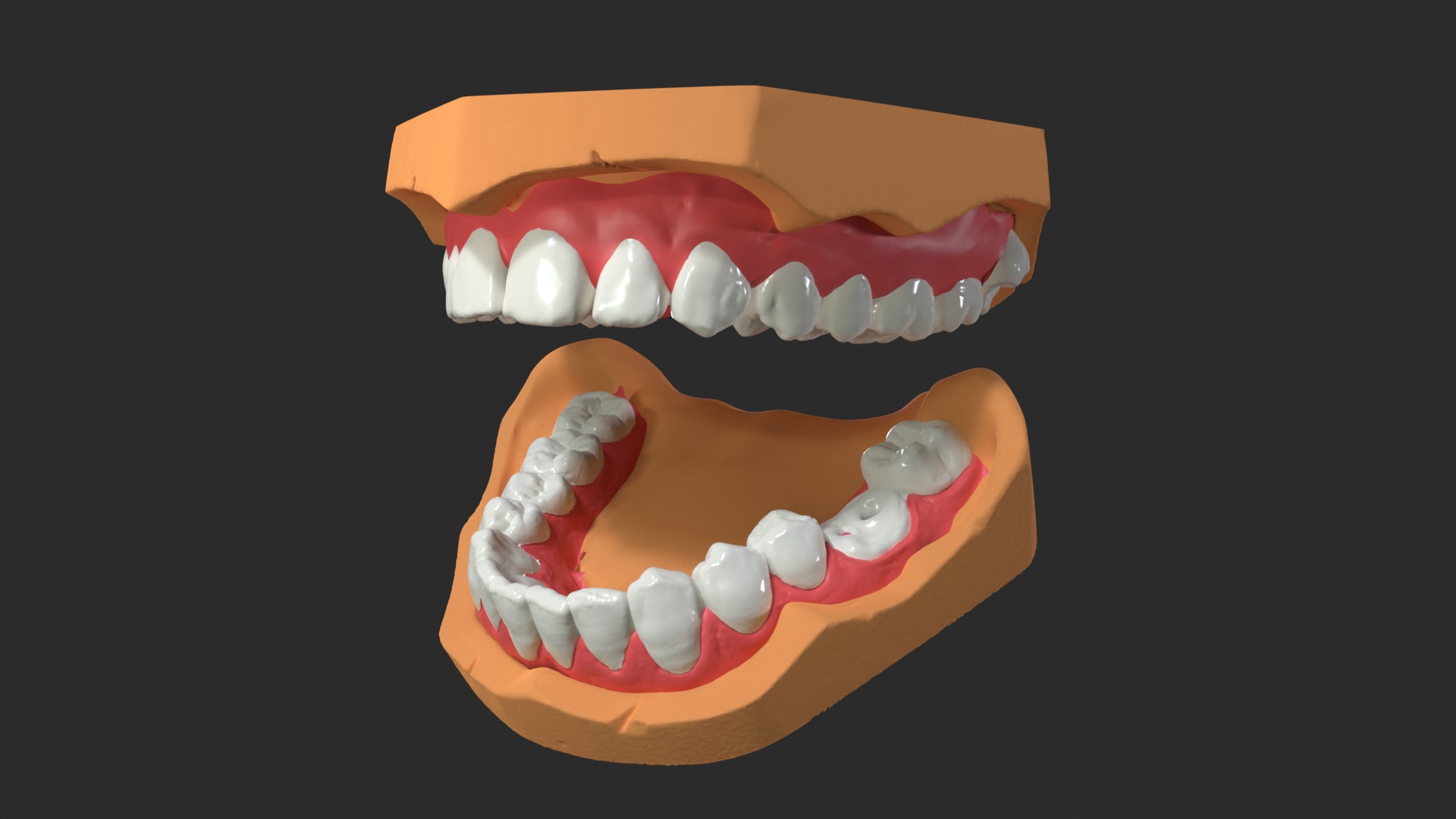 Human Dental Anatomy Mouth with Detached Crown and Inlay  3D print model_6
