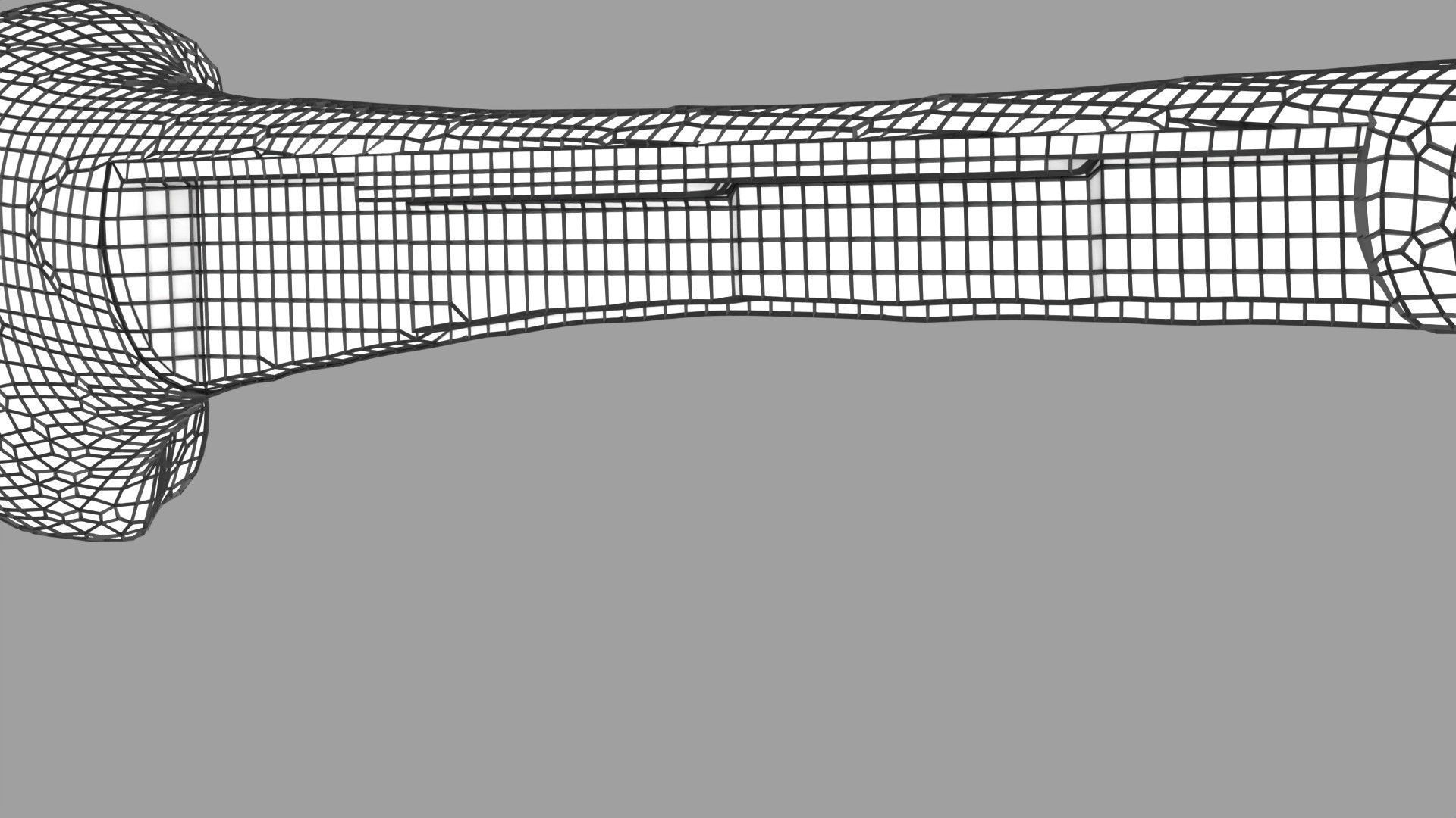Osteoporosis and its stages Low-poly 3D model_65