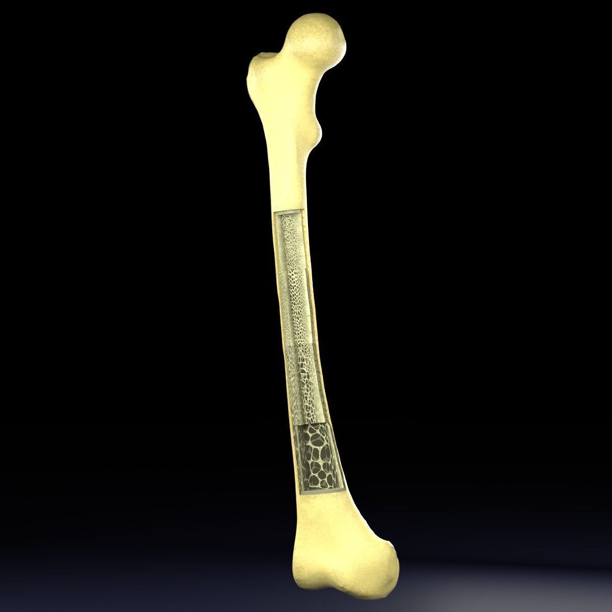 Osteoporosis and its stages Low-poly 3D model_35