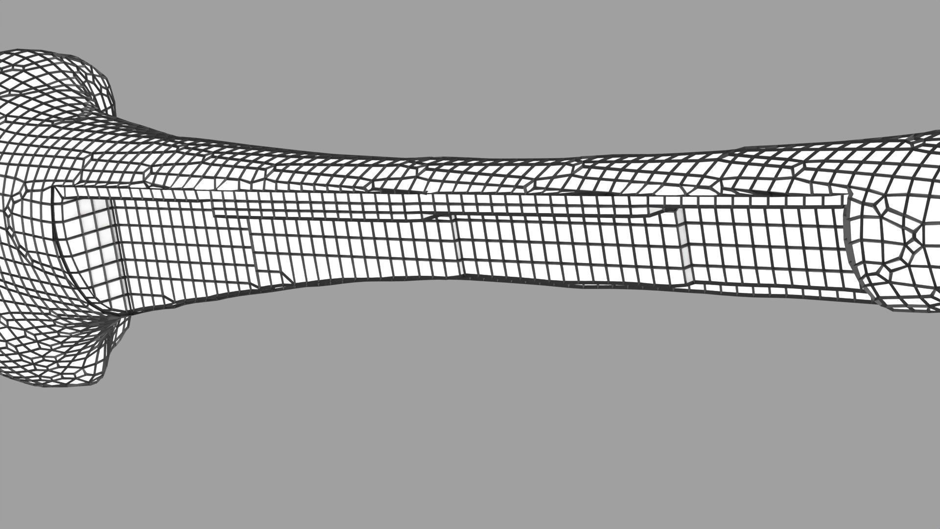 Osteoporosis and its stages Low-poly 3D model_66