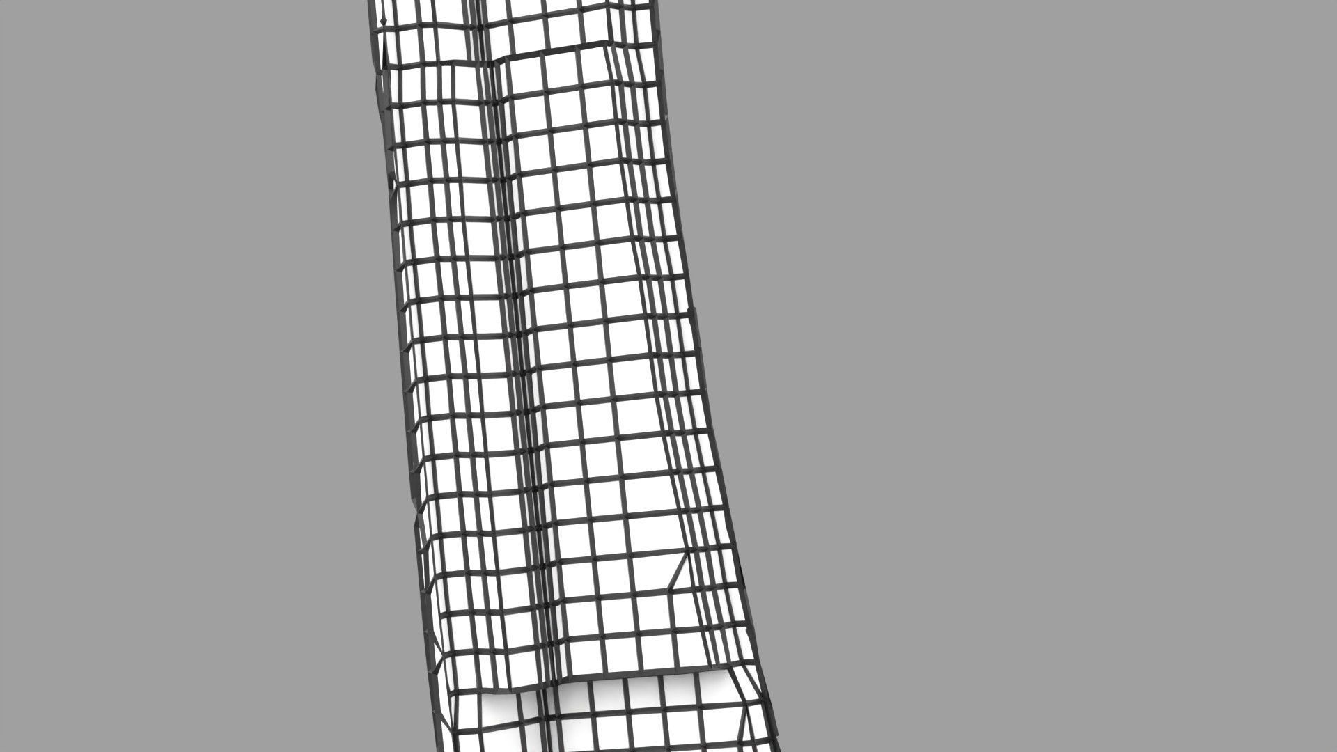 Osteoporosis and its stages Low-poly 3D model_46