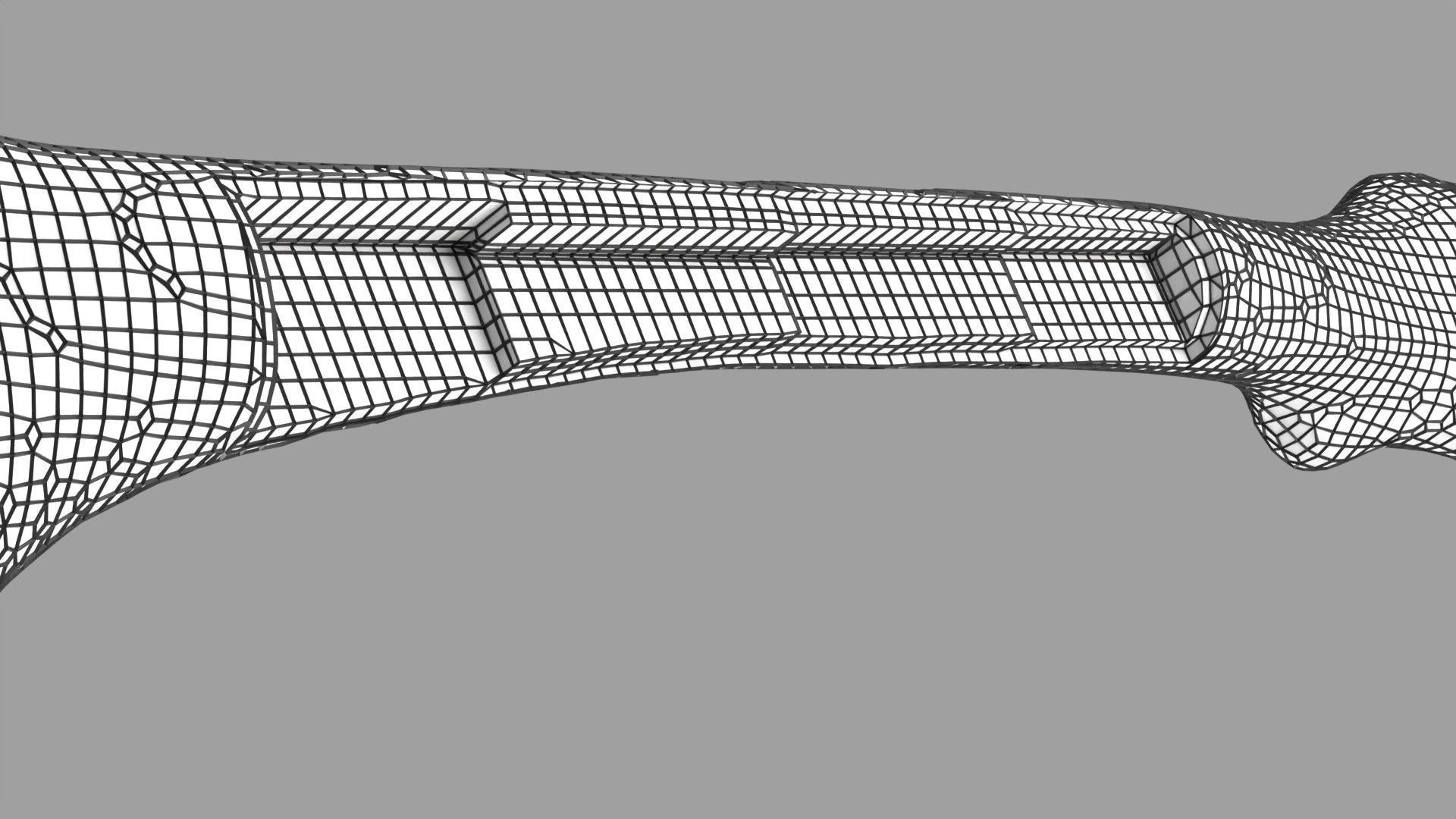 Osteoporosis and its stages Low-poly 3D model_67