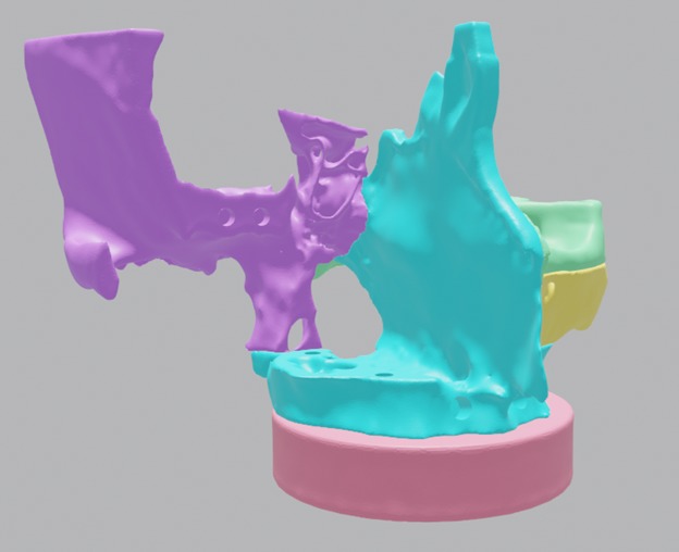 Multiple Parts 3D Printable Nasal Sinus Based on Real CT scan 3D print model_4