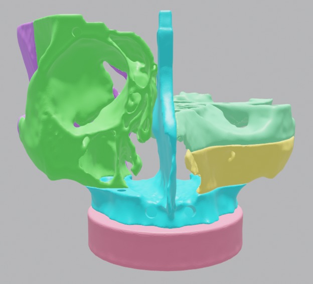 Multiple Parts 3D Printable Nasal Sinus Based on Real CT scan 3D print model_5