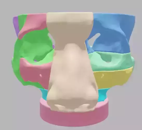 Multiple Parts 3D Printable Nasal Sinus Based on Real CT scan 3D print model