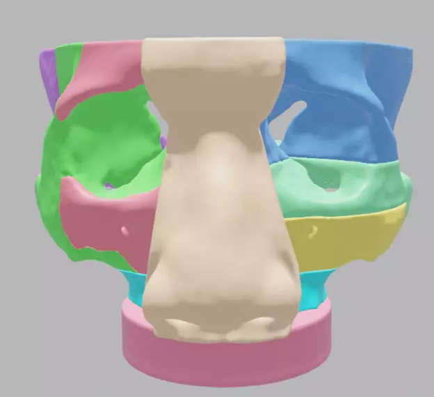 Multiple Parts 3D Printable Nasal Sinus Based on Real CT scan 3D print model_0