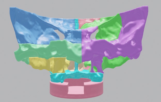 Multiple Parts 3D Printable Nasal Sinus Based on Real CT scan 3D print model_2