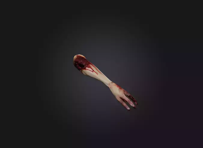 severed arm