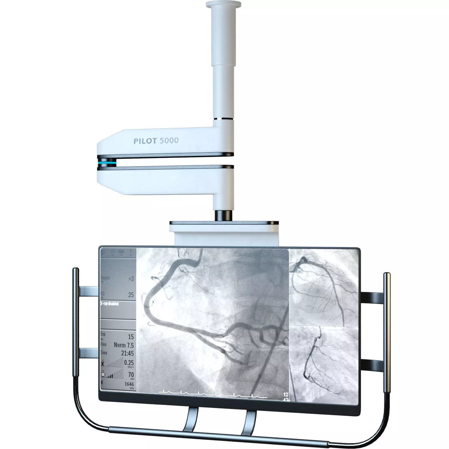 Angiography Imagine Monitor 3D model_0