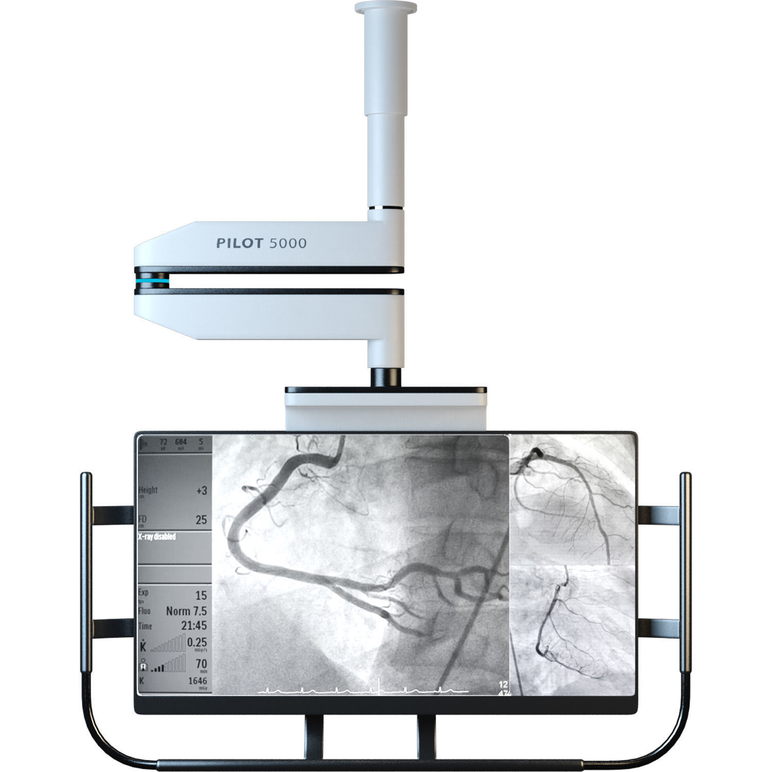 Angiography Imagine Monitor 3D model_1