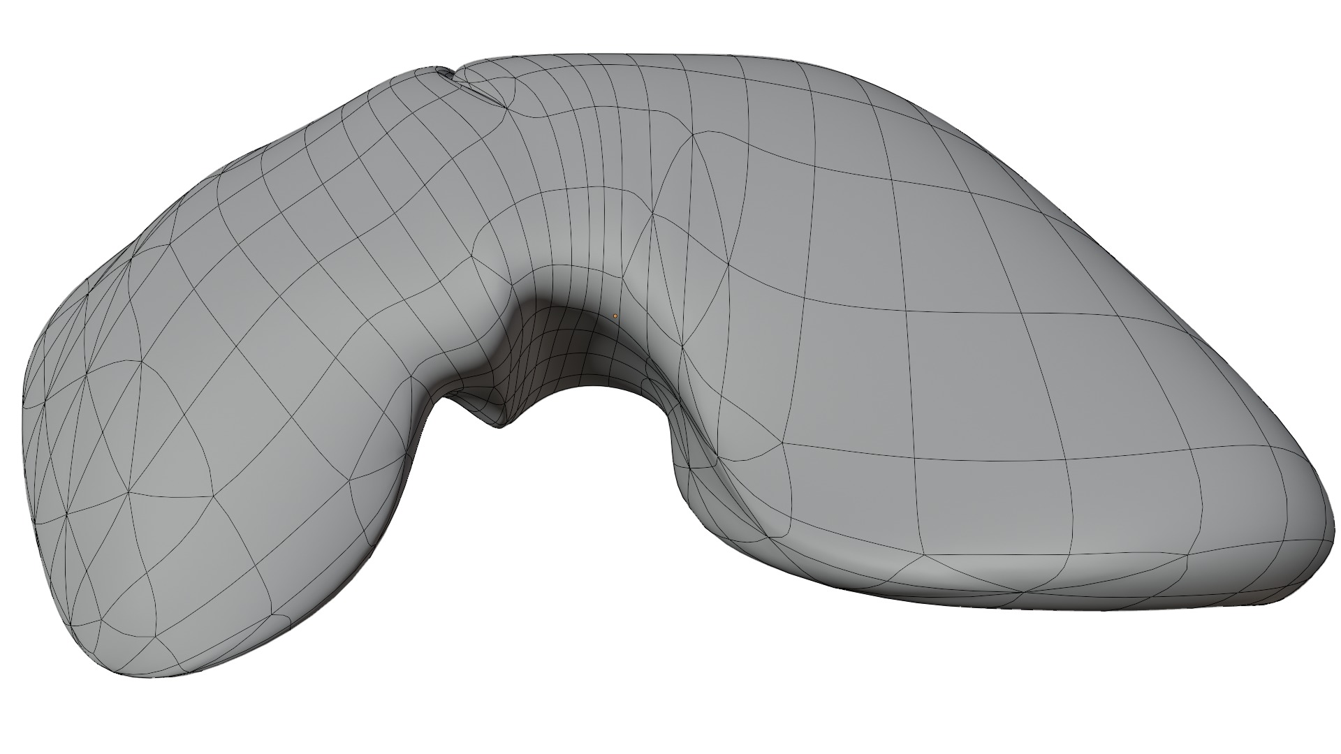 Liver 3D model_17