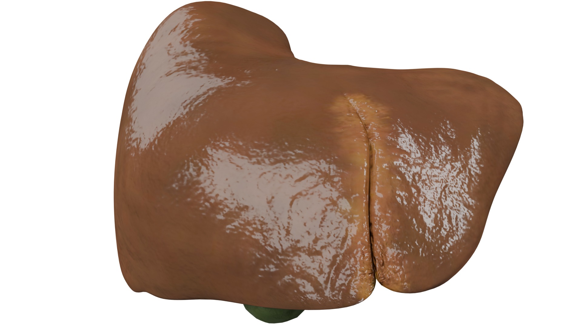 Liver 3D model_1