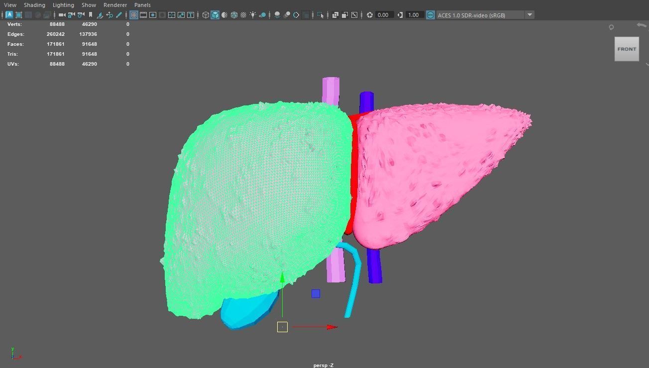 3D Model of Liver with Cirrhosis 3D model_3