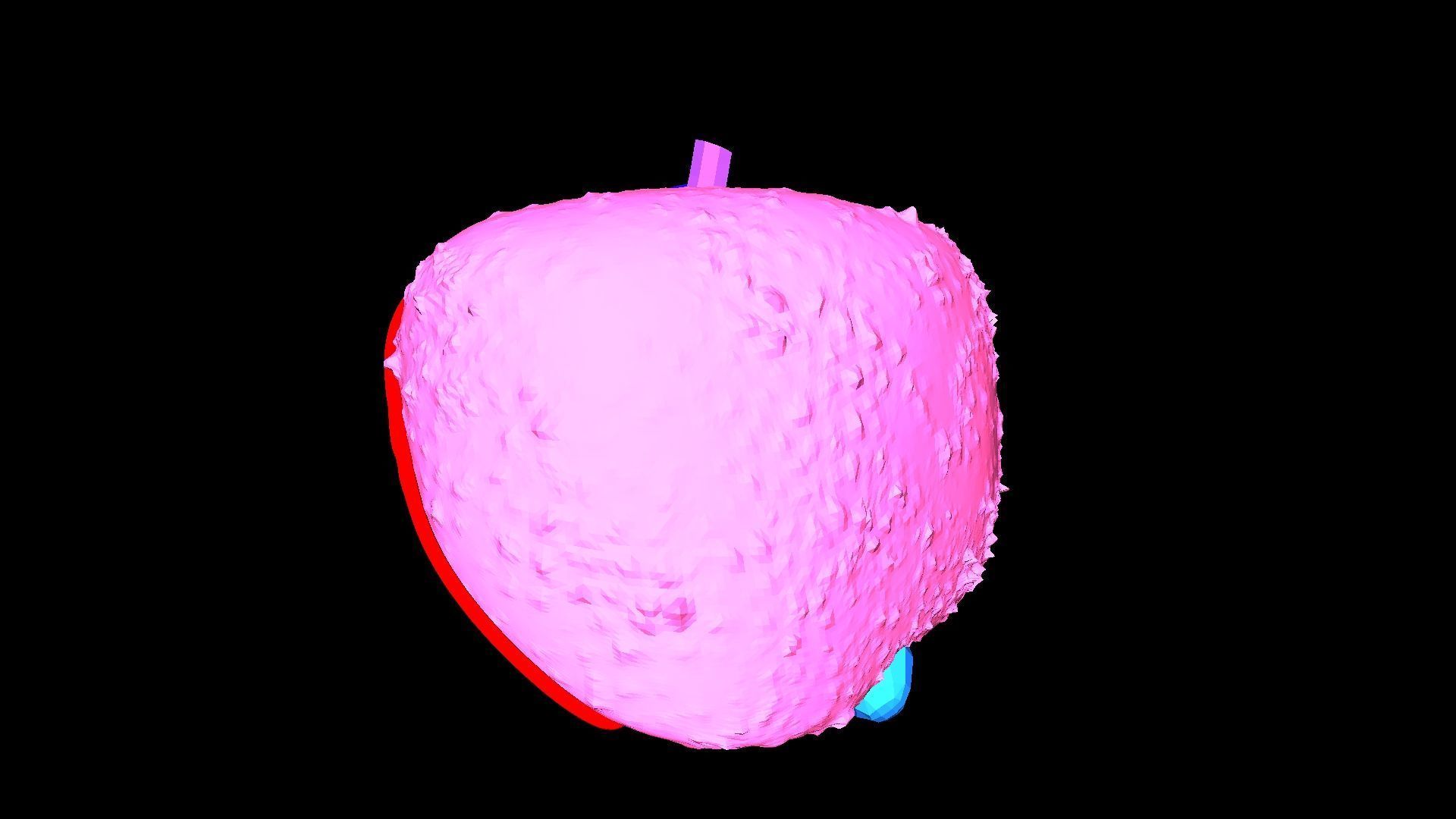 3D Model of Liver with Cirrhosis 3D model_14