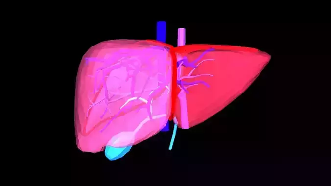 3D Models of Liver Disease - bundle - 6 pack