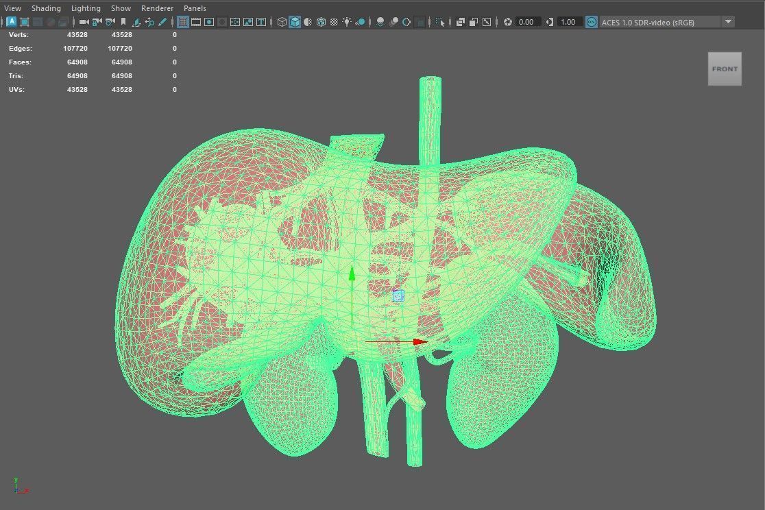 3D Model of Pre- and Post- Operative Liver 3D model_4