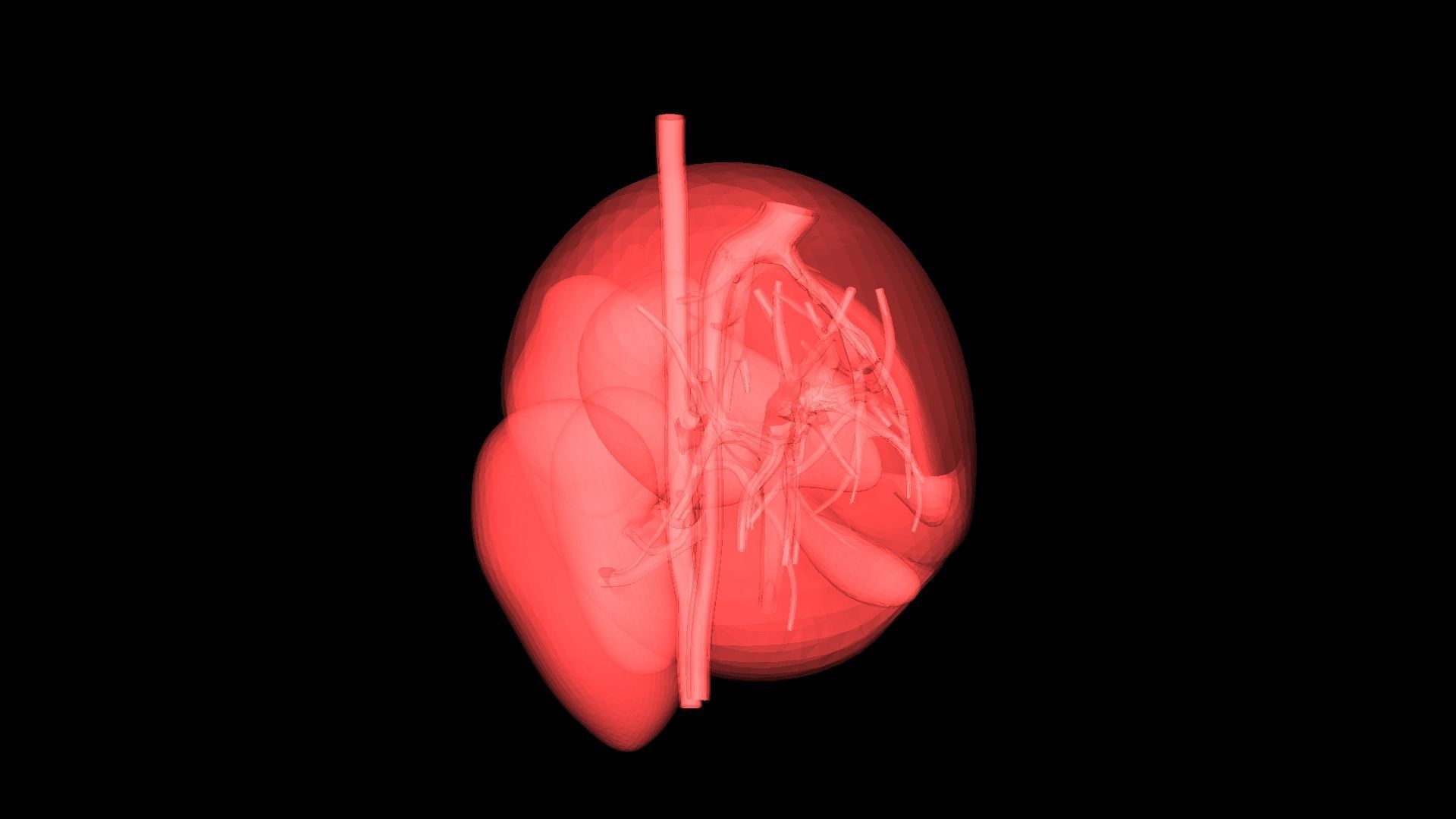 3D Model of Pre- and Post- Operative Liver 3D model_2